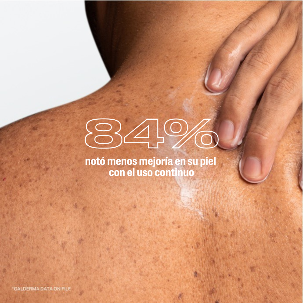 Pro AD Restoraderm Loci&oacute;n Hidratante Corporal